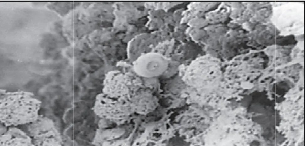 Figure 13. Formation de biofilm complexe par 