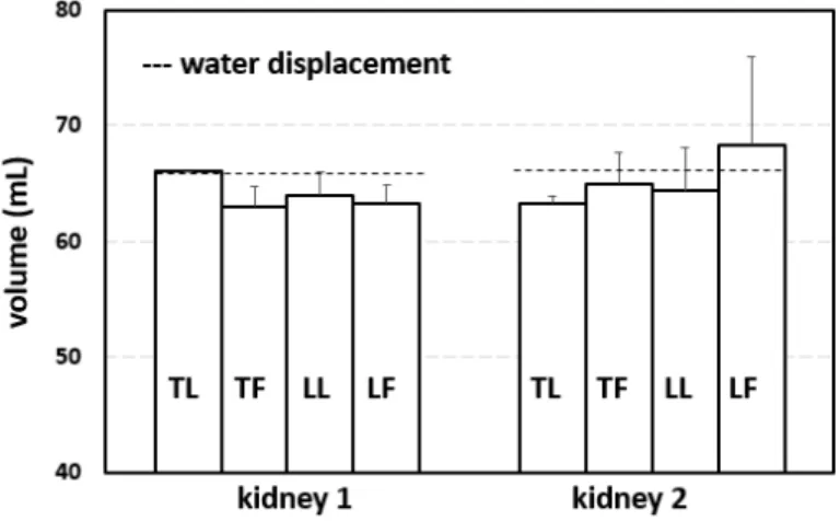 Figure 2-10: Volume estimates using freehand ultrasound scans (kidney 1 and kidney 2)