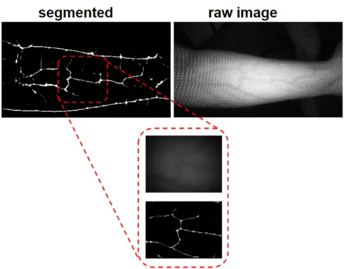 Figure 3-4: Raw infrared image of the forearm (right) and segmented image (left) at a resolution of 240 pixels x 424 pixels