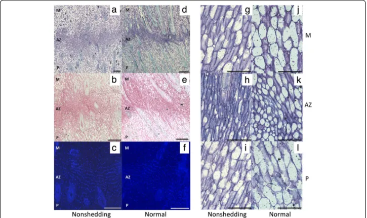 Fig. 4 No abnormalities are observed in the non-shedding MTC180 AZ that has characteristics of a functional AZ