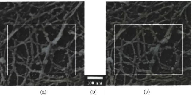 Figure  11  Example  of electron  microscope  stereo  images  (400x400  in pixels) of cell cytoskeleton  which were taken  at  ±10*  of tilt angles:  (a) left image;  (b)  scale bar;  (c)  right