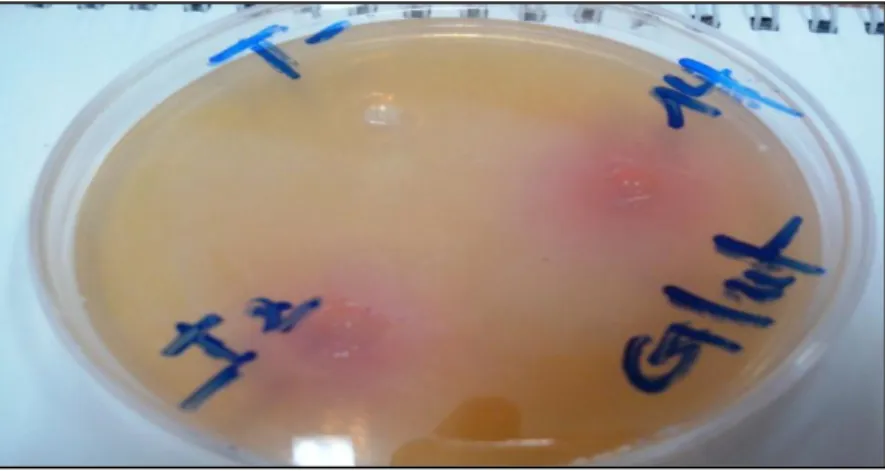 Figure 09: Activité de la L-glutaminase dans les extraits bactériens I2 et 14 sur milieu MGA 