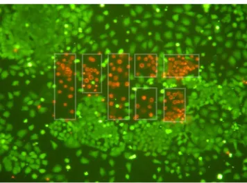 Figure 5.   50% cell death radius as a function of defocus for  different exposure values.