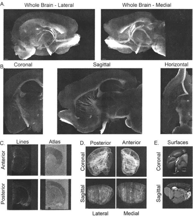Figure 4:  White-matter based  hand  segmentation  of brain  areas provides  robust  identification  of specific regions