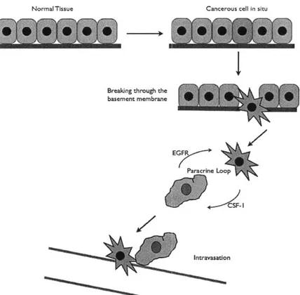 Figure  1-1:  The  process  of  invasion  and  metastasis.  A  normal  cell  becomes  cancerous.