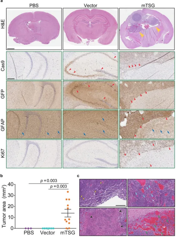 Figure 2. AAV-mTSG induced brain tumors recapitulate pathological features of GBM (a) Top panel, representative H&amp;E brain sections from PBS, AAV-vector and AAV-mTSG  injected mice