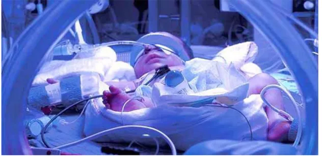 Figure I. 1 : un nouveau-né dans un incubateur 