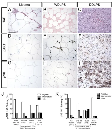 Fig. 2. Osteosarcoma development in a rag2:myr-mAkt2-injected, p53-ho- p53-ho-mozygous mutant zebra ﬁ sh