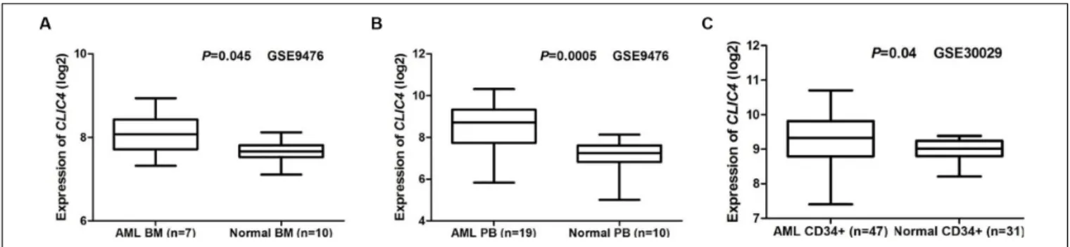 FIGURE 1 | Different expressions of CLIC4. (A) AML bone marrow samples (n = 7) vs. normal bone marrow samples (n = 10)