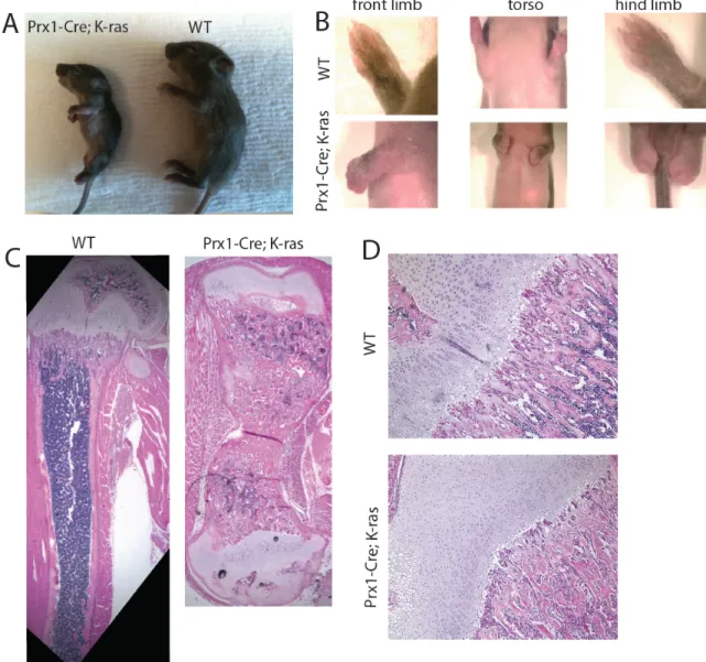 Figure   1.   Expression   of   K-­ras G12D    in   mesenchymal   progenitors   causes   Noonan-­