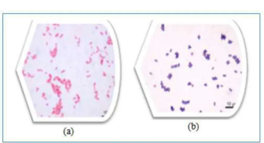 Figure 6 : Aspect des bactéries après coloration  de Gram vue au microscope  optique(Gх100) 
