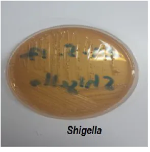 Figure  07:  Photo colonies lactose +                           Figure  08 :  Photo colonies lactose –                     sur  milieu Mac Conkey sur  milieu Mac Conkey Coloration de Gram