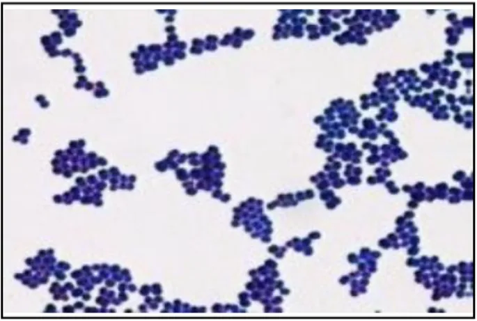 Figure 8 :  Staphylococcus  aureus,  coloration  par  la  méthode  de  Gram (Chiguer, 2014) 