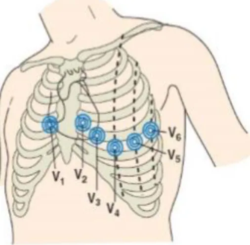 Figure I.5 : Dérivations thoraciques [8]. 