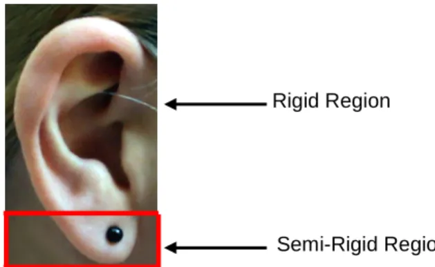 Fig. 2.  Example of separation between Rigid and Semi-Rigid Regions. 