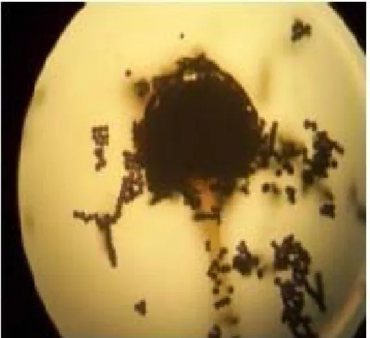 Figure 13 : Aspects microscopiques (Gx100) des espèces aspergillaires testée,  après culture   sur milieu PDA