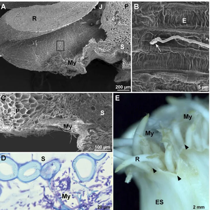 Figure 2. Mycelium development of Fusarium proliferatum. A, SEM micrograph of a germinating garlic root