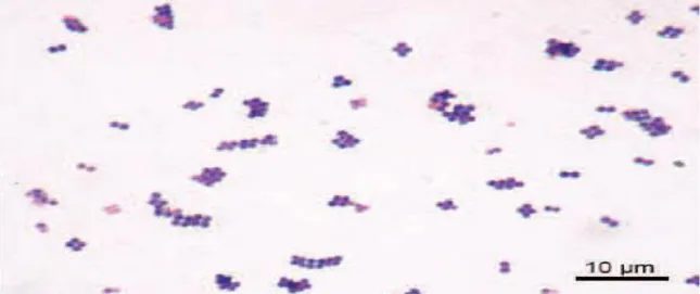 Figure  2:  Photographie  prise  au  microscope  électronique  montrant  la  forme  de  coques  des  cellules de S