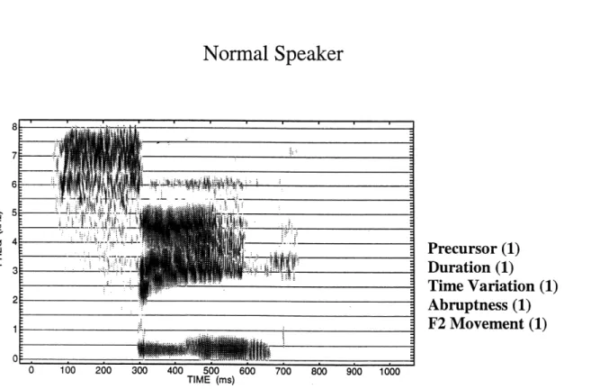 Figure  3.2 gives  examples  of spectrograms  of three  productions  of &#34;see&#34;:  one by  a normal speaker,  one  by a  highly  intelligible  dysarthric  speaker,  and  one  by  a  dysarthric  speaker with  low  intelligibility