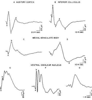 Figure  2  shows  average  click-evoked  responses  that  are  representative  of  evoked potentials  recorded  in this  study  from  the  several  auditory  structures