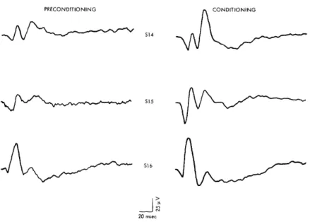 Fig.  3.  Average  click-evoked  cortical  responses  from  three  subjects  taken from  last  preconditioning  session  and  second  conditioning  session of  a  CER  situation
