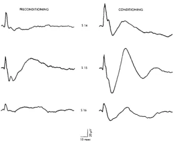 Fig.  7.  Average  click-evoked  responses  recorded  from  mesencephalic reticular  formation  in  3  subjects