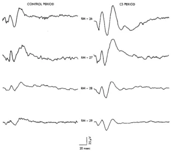 Fig.  13.  Average  click-evoked  cortical  potentials  from  last  condi- condi-tioning  session for  all 4  subjects