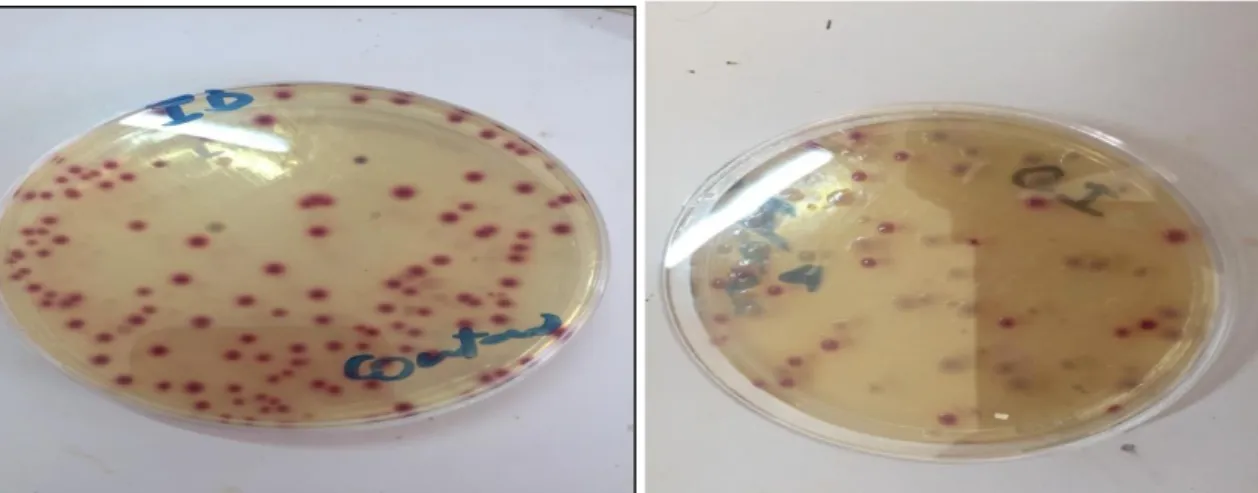 Figure 08 : Aspect des colonies d’E. coli sur le milieu CHROMID. 
