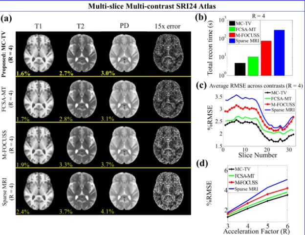 Figure 2.2: SRI24 atlas results at several acceleration factors. (a) Reconstructed T1- T1-, T2-T1-, and PD-weighted images of slice three with corresponding RMSEs (yellow).