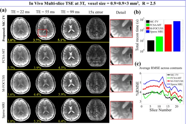 Figure 2.3: In vivo results at R = 2.5. (a) Reconstructed 3-contrast images of slice nine with corresponding RMSEs (yellow)