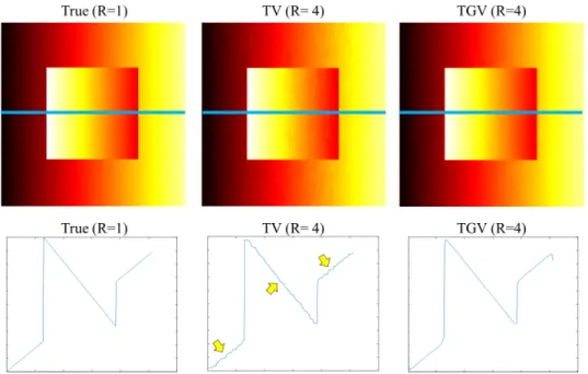 Figure 2.4: Total variation (TV) and total generalized variation (TGV) reconstruc- reconstruc-tions at an acceleration factor of four (R=4)