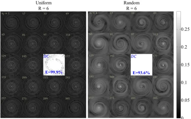 Figure 3.3: An example of the point spread function (PSF) obtained from the uniform (left) and random (right) spiral-based k-space acquisition schemes at R=6
