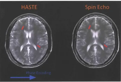 Figure  2-7:  Images  generated  from  simulated  HASTE  and  Spin  Echo  acquisitions.