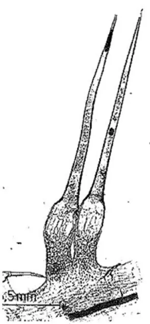 Figure 5 : Poils urticant caractéristique          Figure 6 : Extrémité sphérique d’un poil                        d’Urtica dioica (Draghi, 2005)