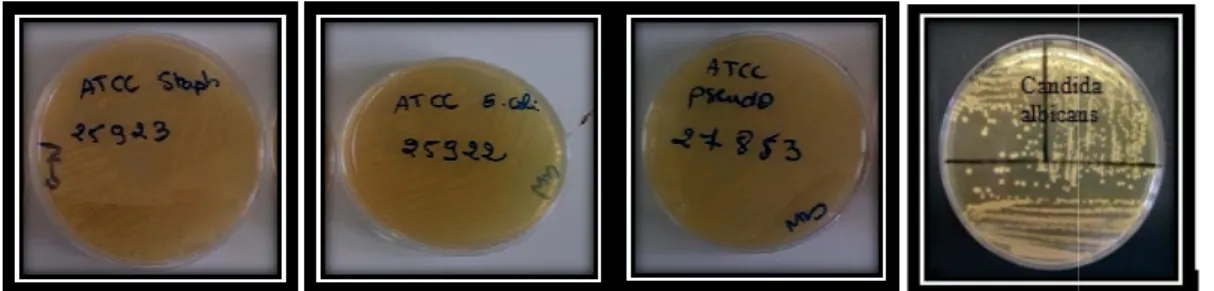 Figure 09 III-2-6 : Antibiogramme     A) Principe 