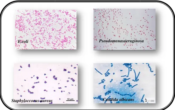 Tableau 04 : Observations microscopique des différentes souches étudiées Bactéries 