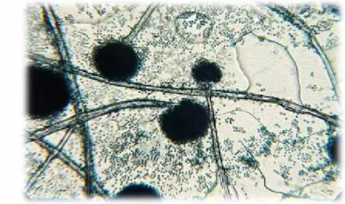 Figure 18 : Aspergillus niger sous microscope (G x40).