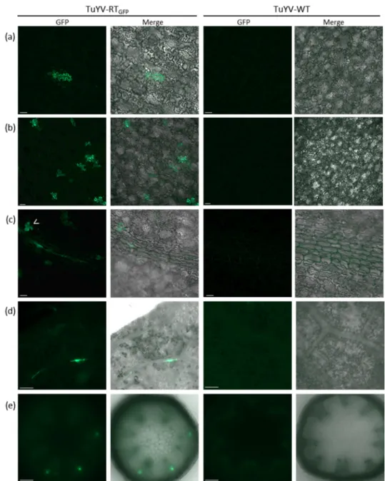 Figure 5. Cellular localization of EGFP fluorescence in the inoculated or systemic leaves of infected  plants after aphid delivery of TuYV-RT GFP  or TuYV-WT