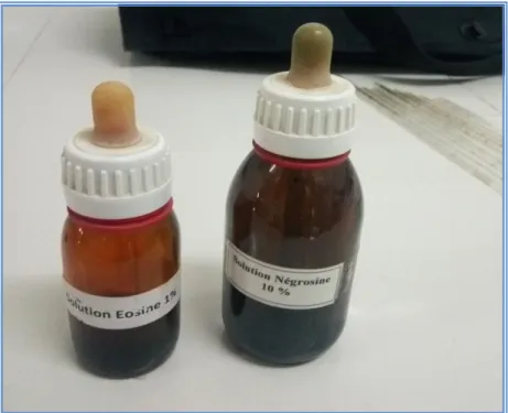 Figure 10 : Eosine et de la Nigrosine» pour étude de la vitalité des spermatozoïdes (origine)