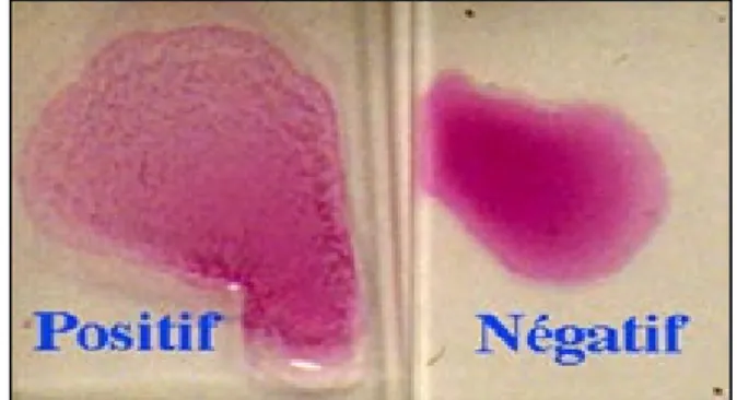 Figure 8 : Test  rose Bengale Khettab et al. (2010) 