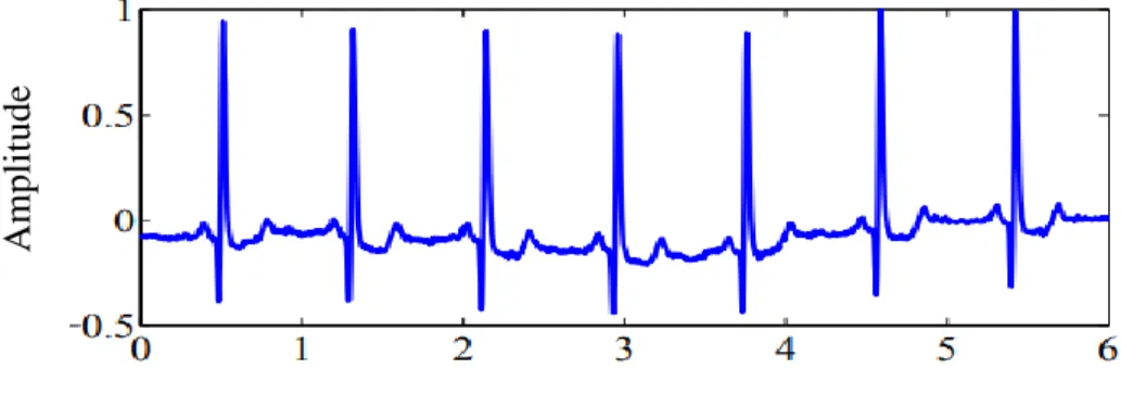 Figure I. 9. Rythme sinusal [21]. 