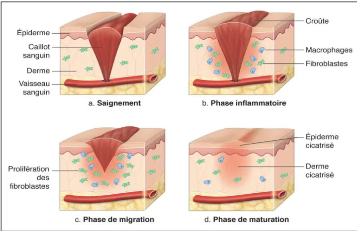 Figure 7: Phases de cicatrisation (Martinet, 2018).