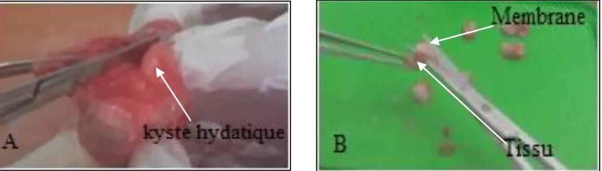 Figure 08 : Image d’un poumon infecté par un kyste hydatique(A), réalisation des  coupes macroscopiques (B) (Photographie originale)