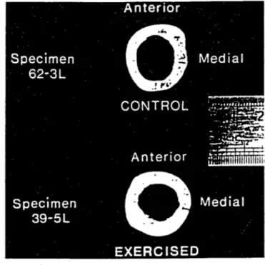 Figure  2.21:  Photographs of Cross-Section  of Proximal  End of Femur in  Swine.  [Woo et al  1981]