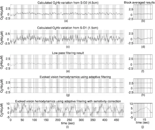 Fig. 3 Adaptive filtering to remove global interference and recover evoked brain activity
