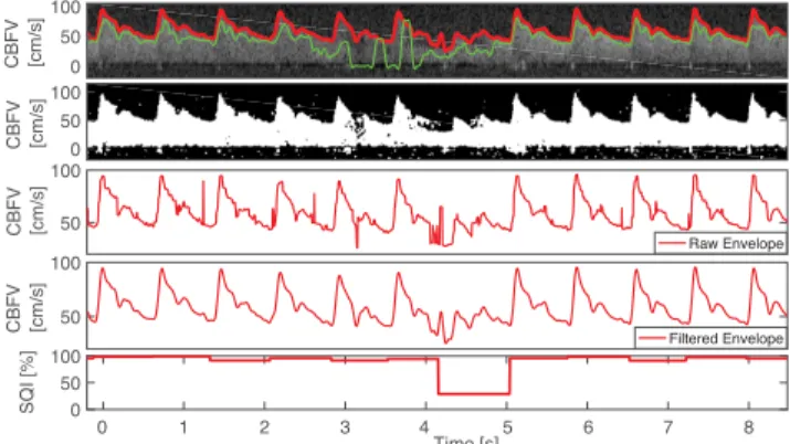 FIGURE 5. First row: Automatic envelope tracing by proposed algorithm (red) and MTCM (green)
