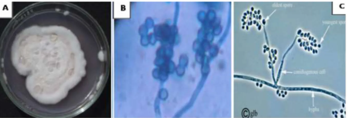 Figure  1.  Macroscopic  (A)  and  microscopic  (B)  characters  of  isolated  Beauveria  bassiana  observed  under  a  light  microscope at (GX100)