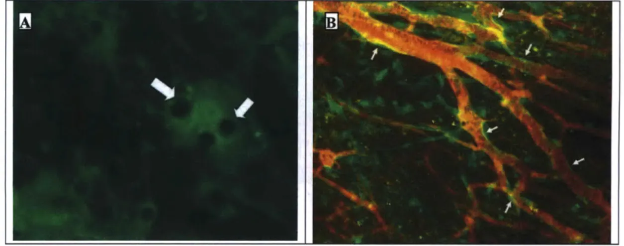 Figure 2-5. (A)  High power view  of structures  resembling  lipid droplets  in  the implanted  ASC after 2 weeks (arrows)