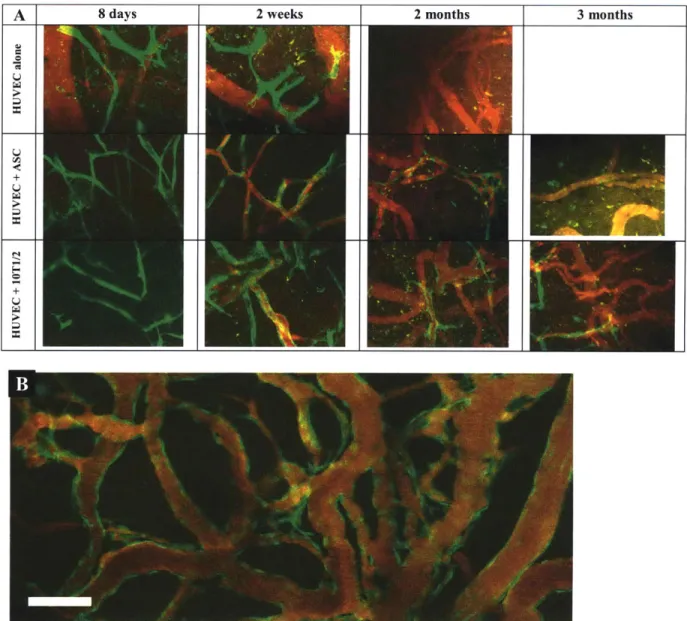 Figure 3-2.  Tissue  engineering  of blood  vessels  in  mice.  Tissue  constructs  were  produced  and implanted  into mice baring  cranial  windows,  as previously  described 47 
