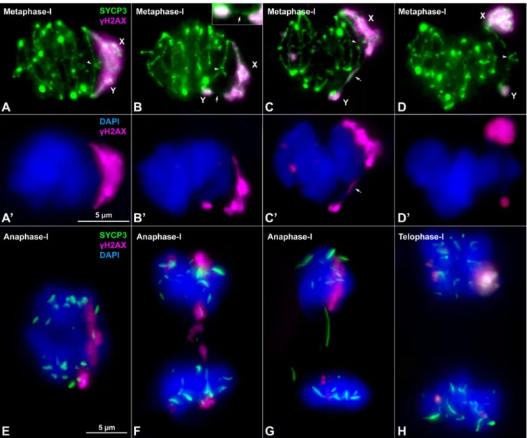 Fig 5. Sex chromosome segregation. Squashed spermatocytes labelled with antibodies against SYCP3 (green) and γH2AX (magenta) and counterstained with DAPI (blue)